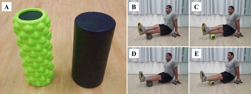 Rodillo tipo rejilla (izquierda) y rodillo liso (derecha) (A), rodillo liso unilateral (B), rodillo tipo rejilla unilateral (C), rodillo liso bilateral (D) y rodillo tipo rejilla bilateral (E).